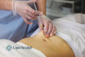 Does Skin Sag After Fat Dissolving Injections? 2 Do you want to get Aqualyx fat dissolving injections Maplehurst but worried about loose skin afterwards?