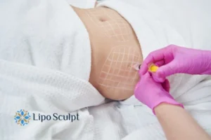 Are The Results From Aqualyx Permanent? 1 Do you want to know how long Aqualyx Maplehurst results last?