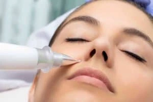 Best Actinic Keratoses Removal 3 Actinic keratoses Maplehurst solutions - book in today!