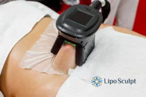 Does Fat Freezing At Home Work? 3 Fat freezing at home from Lipo Sculpt Maplehurst